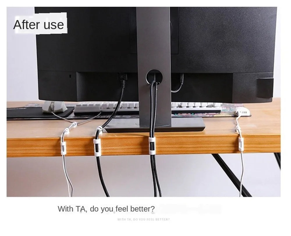 Pillar Cable Manager Set
