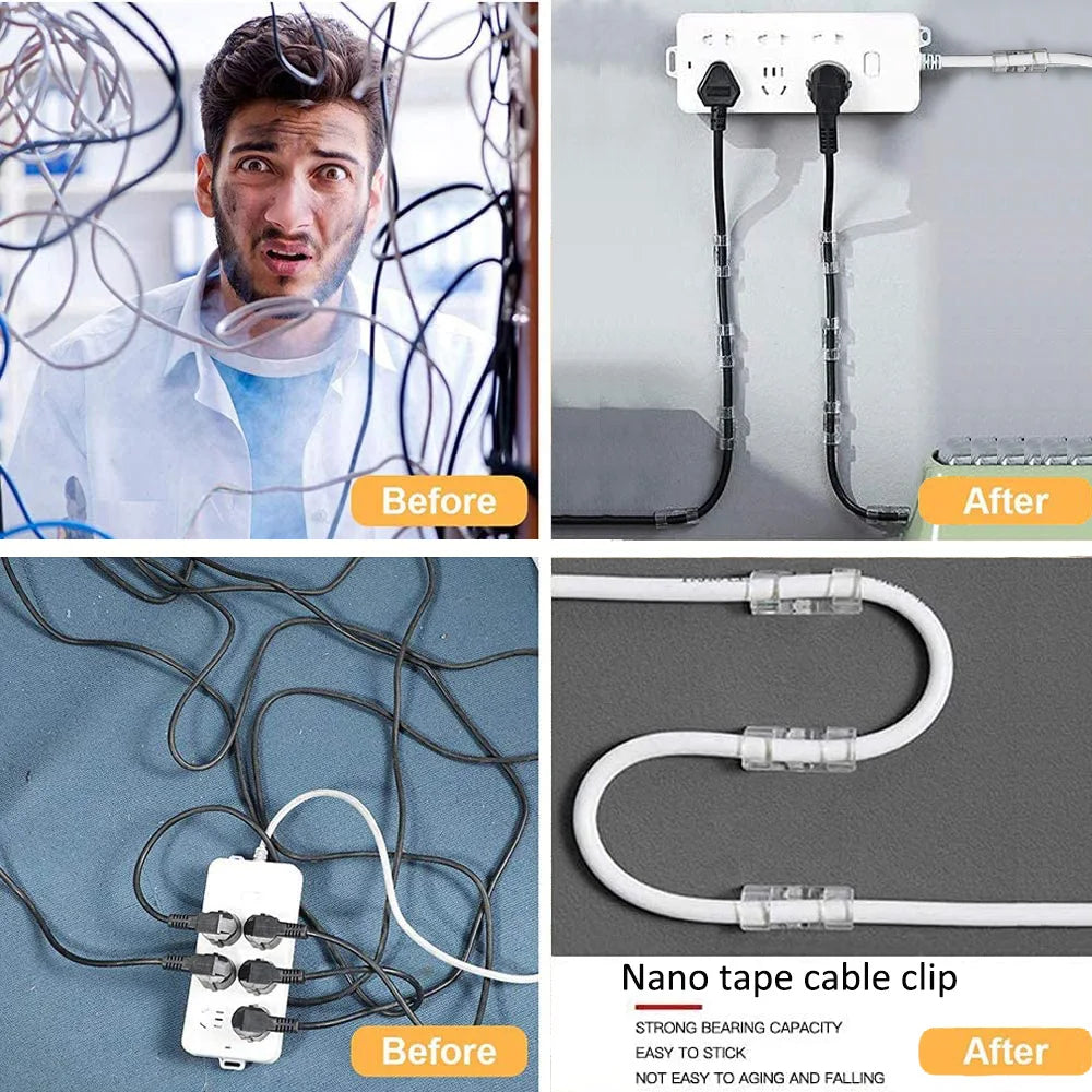 Pillar Cable Manager Set